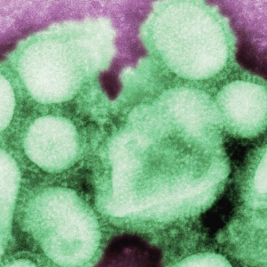 쿼드데믹 관련주 대장주 테마주 주식 TOP7