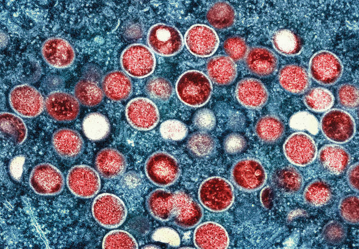 엠폭스-바이러스