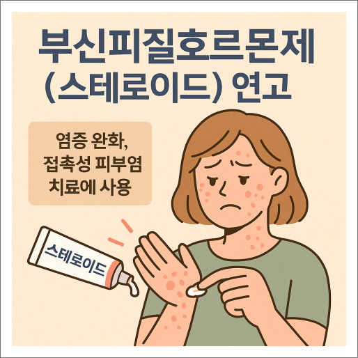 접촉성 피부염 증상과 부위별 치료법_스테로이드연고
