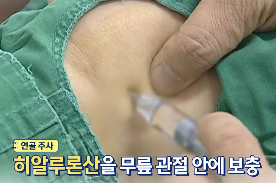 가자추출물