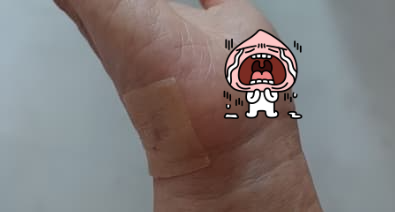 습윤밴드