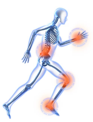 퇴행성 관절염 증상 26