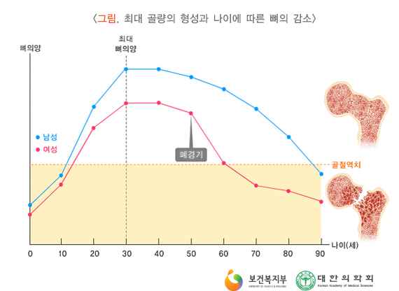 골밀도그래프