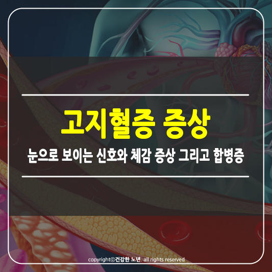 고지혈증 증상 썸네일