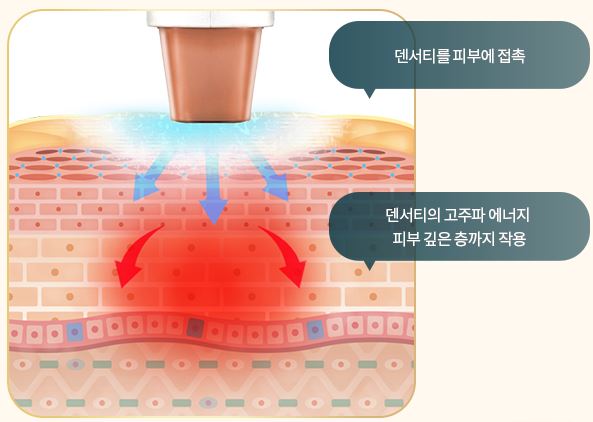 덴서티 효과