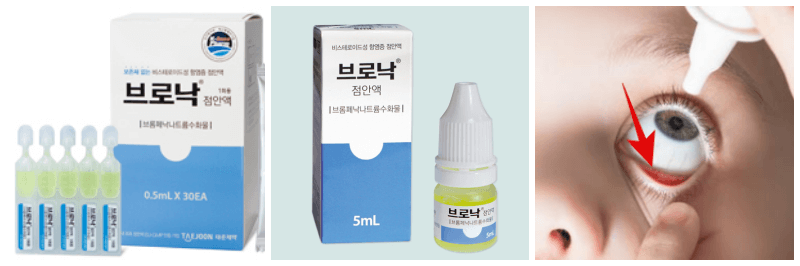 브로낙점안액&#44; 안약 넣는 사진
