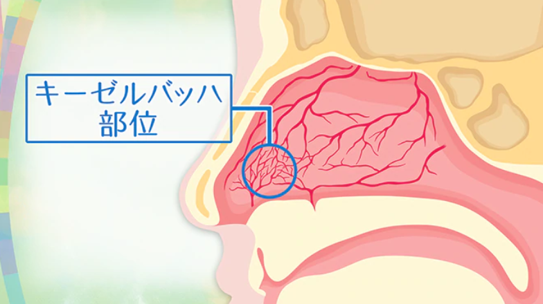 코피 대처 하는 방법