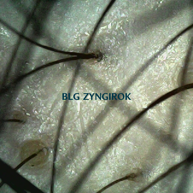 피나모아 복용 16주차 - 정수리와 이마 사이 두피 모습이다.