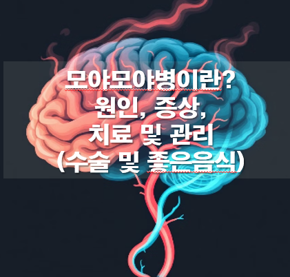모야모야병이란? 원인, 증상, 치료 및 관리(수술 및 좋은음식)