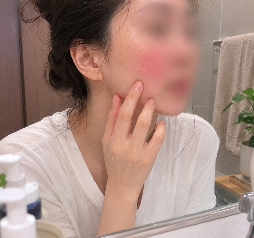 거울을 보며 뺨의 안면홍조와 붉은기 트러블을 확인하는 40대 여성의 주사피부염 초기 증상 및 피부장벽 붕괴 모습