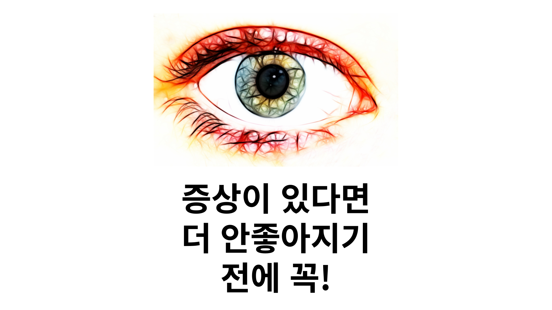 비문증 자가진단법