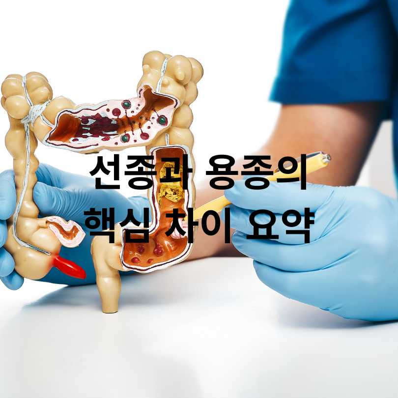 선종과 용종의 차이