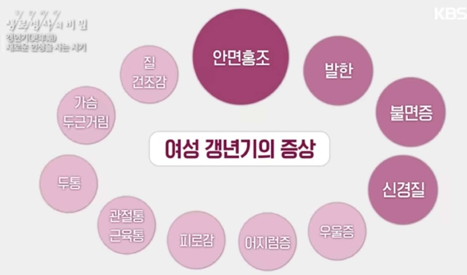 여성갱년기증상