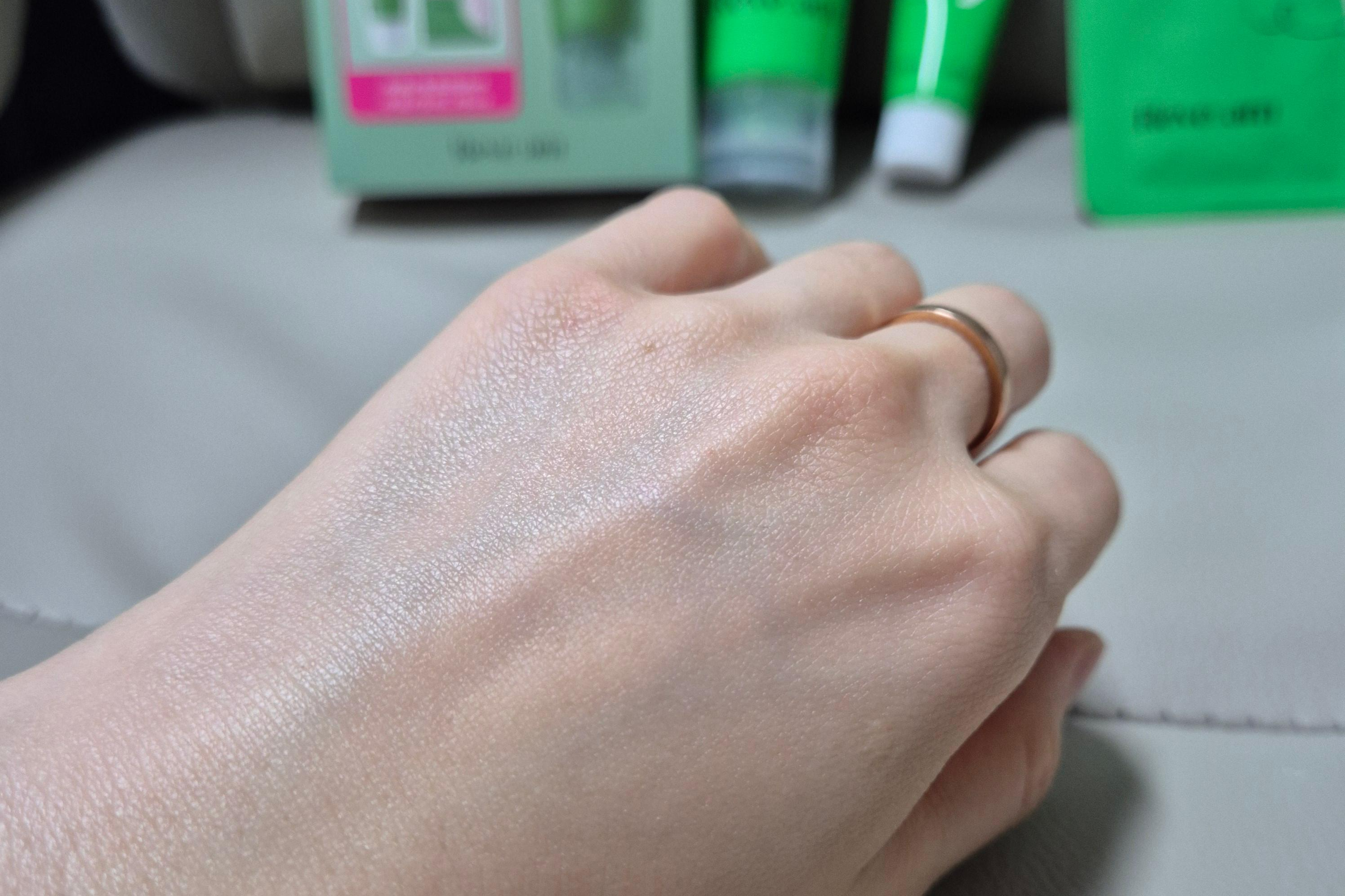 시카좀젤크림 바른 직 후