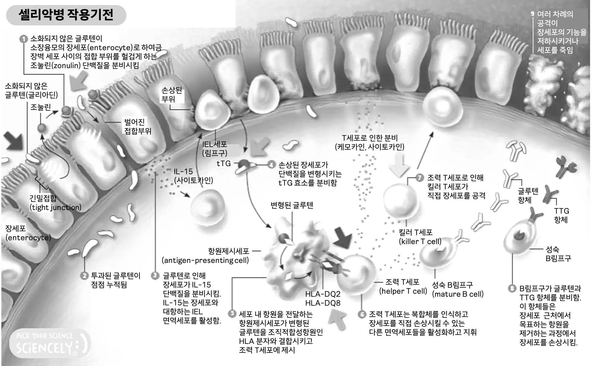 셀리악병 작용기전, 장세포, 조눌린, 소장융모, 글루텐, 접합부위, IL-15, 사이토카인, IEL세포, 림프구, 면역세포, TTG 효소, 단백질 변형, 변형 글루텐, 항원제시세포, 조직적합성합원, HLA, 조력t세포, 케모카인, 복합체, 킬러t세포, b세포, b림프구, 항체, 세포 손상