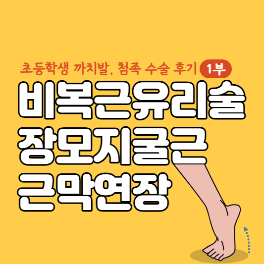 비복근유리술-장모지굴근-근막연장-썸네일
