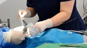 쓸개 제거 수술