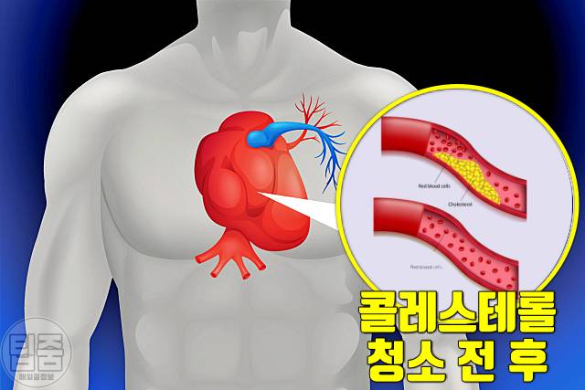 아보카도 매일 먹으면 아보카도 효능 아보카도 1인분 심장 혈관 청소