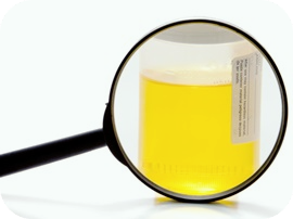 간수치가-높으면-나타나는-증상