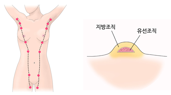 밀크라인