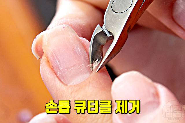 손톱 갈라짐 이유 손톱부러짐 큐티클
