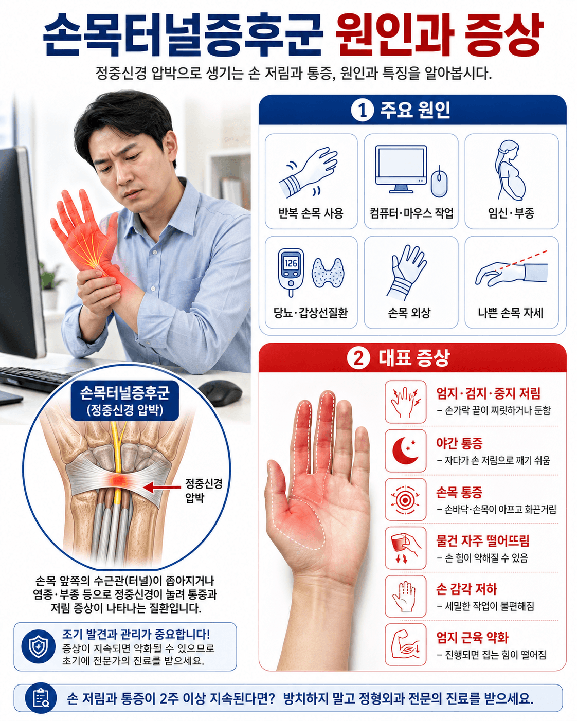 손목터널증후군 원인과 증상
