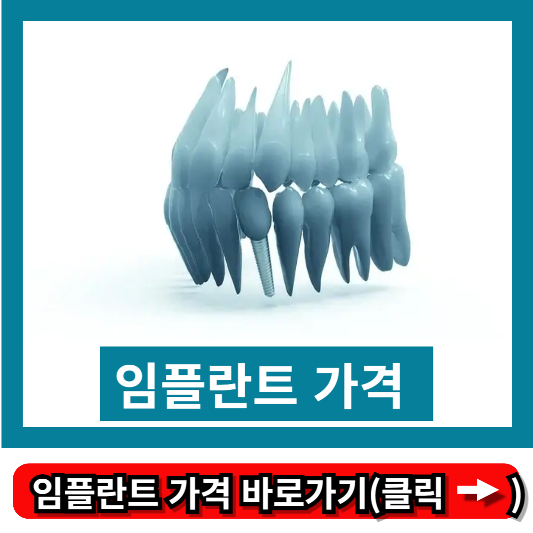임플란트 가격