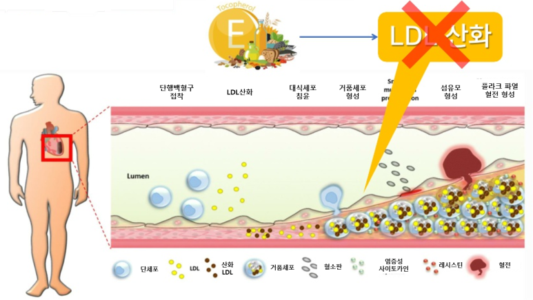 비타민E LDL산화
