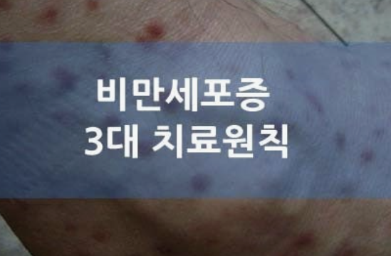 비만세포 없애는 방법 - 제가 3개월간 직접 시도한 결과