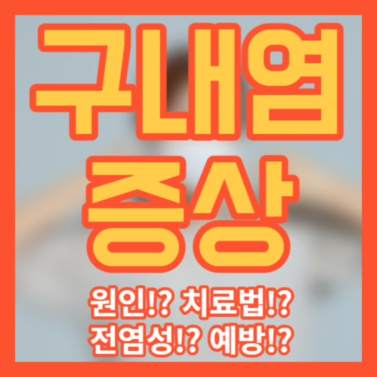 구내염 증상 - 원인!? 치료법!? 전염성!? 예방!?