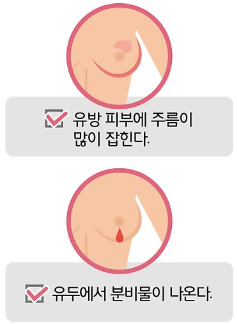 유방암 증상