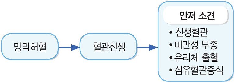 당뇨망막병증