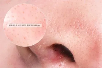 남자 얼굴 피지 제거 화장품 꿀템_4