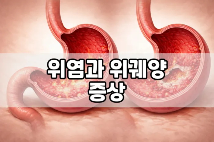 위염 증상과 위궤양 증상