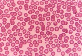 백혈구 정상수치