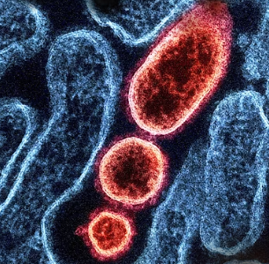 섬유근육통 초기증상 원인 치료법