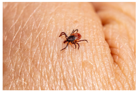 진드기의 확산: 라임병과 새로운 병원균의 위협