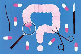 맹장의 위치과 증상