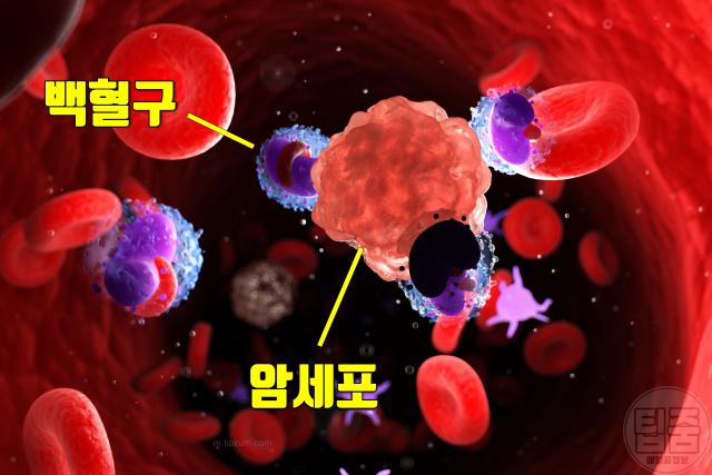 혈액암 증상