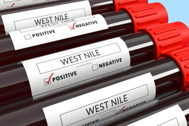  웨스트나일 바이러스 감염 