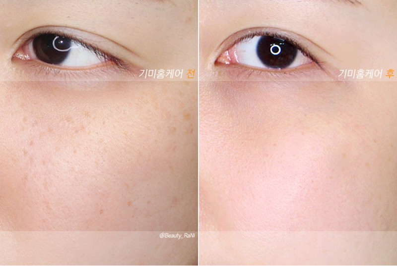 ๊ธฐ๋ฏธ ์์ ๋ ๋ฐฉ๋ฒ