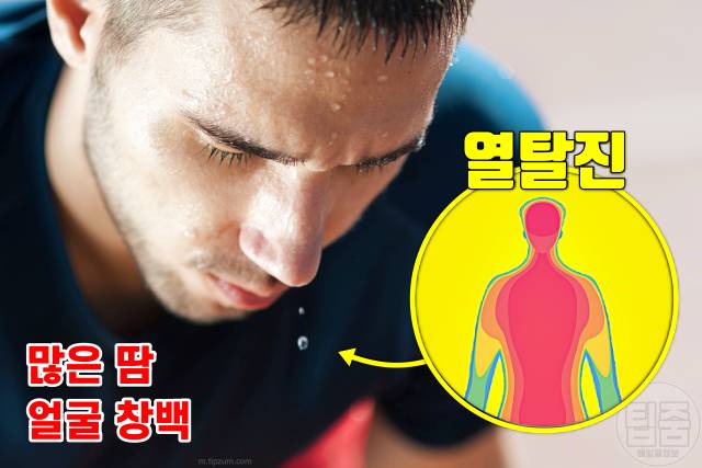 더위 먹은 증상 얼굴창백 더위 먹었을때 대처 회복기간
