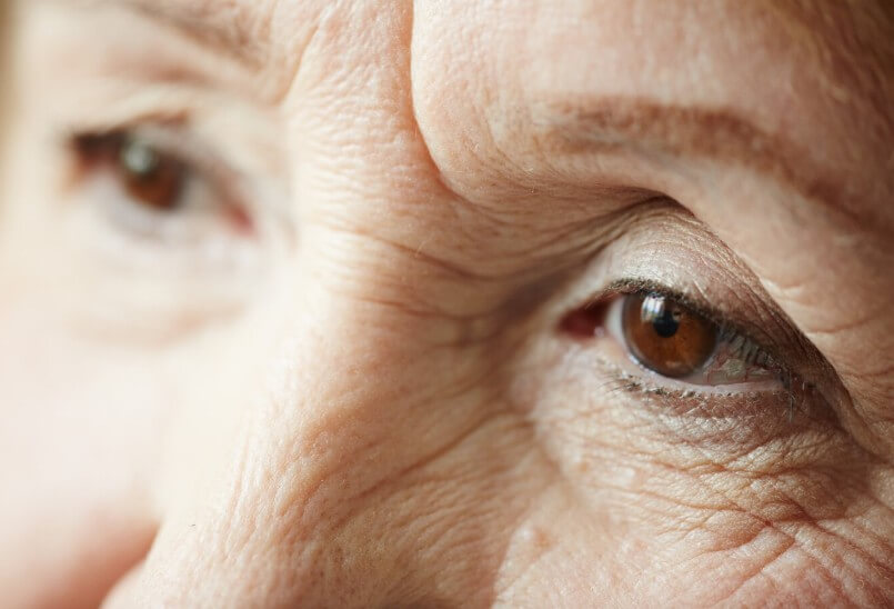 백내장이 온 할머니