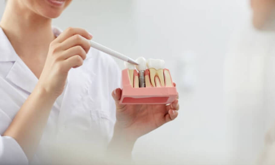임플란트 잇몸뼈