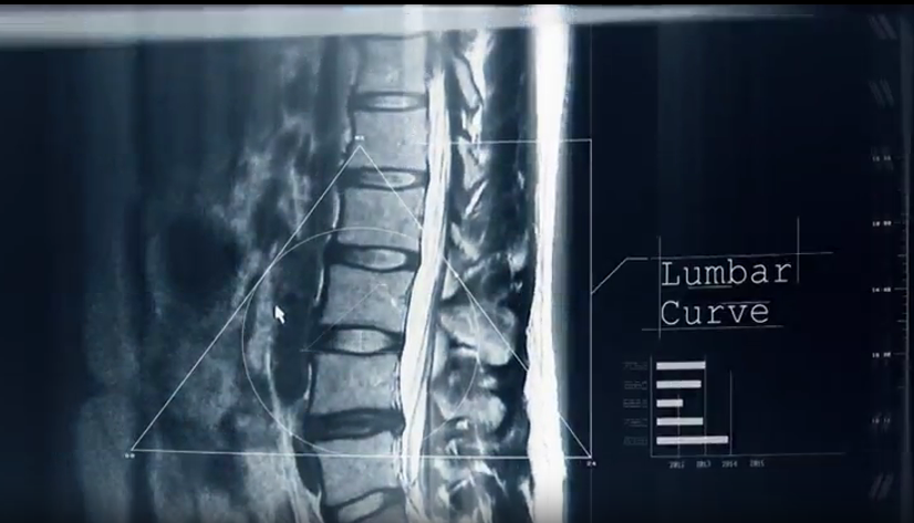 명의 피부암 점 구별법