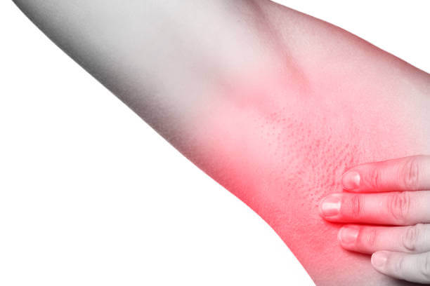 겨드랑이 멍울&#44; 통증 원인 및 예방법입니다. 멍울로 인한 통증과 불편함은 상당히 심각한 문제일 수 있습니다. 하지만 걱정하지 마세요. 이 글에서는 겨드랑이 멍울의 원인과 예방법&#44; 그리고 치료 방법을 알려드리겠습니다. 이제부터 멍울 걱정은 이제 그만! 겨드랑이 건강을 지켜보세요.