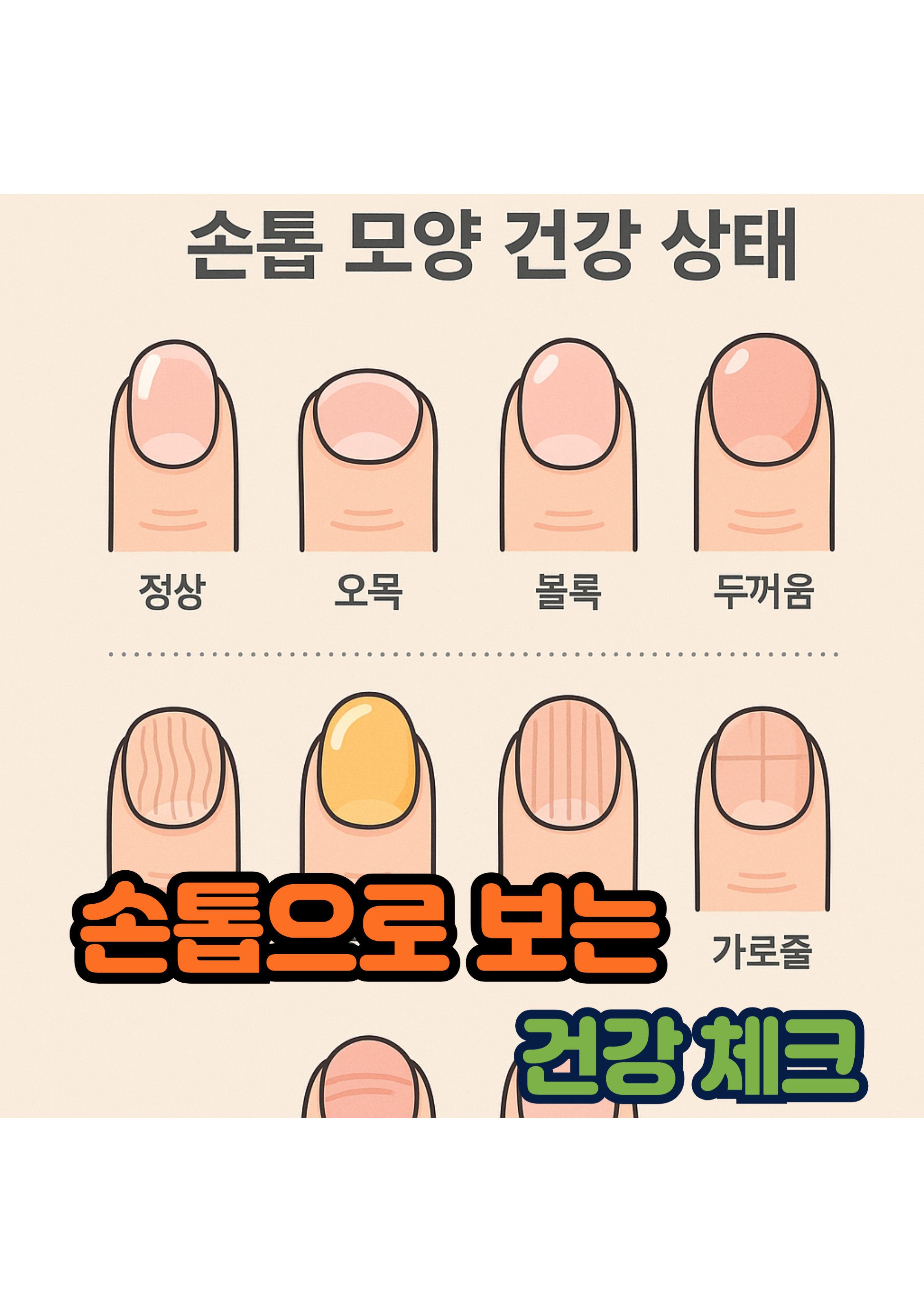 1.손톱으로 보는 건강 상태