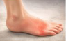 발바닥통증의 원인