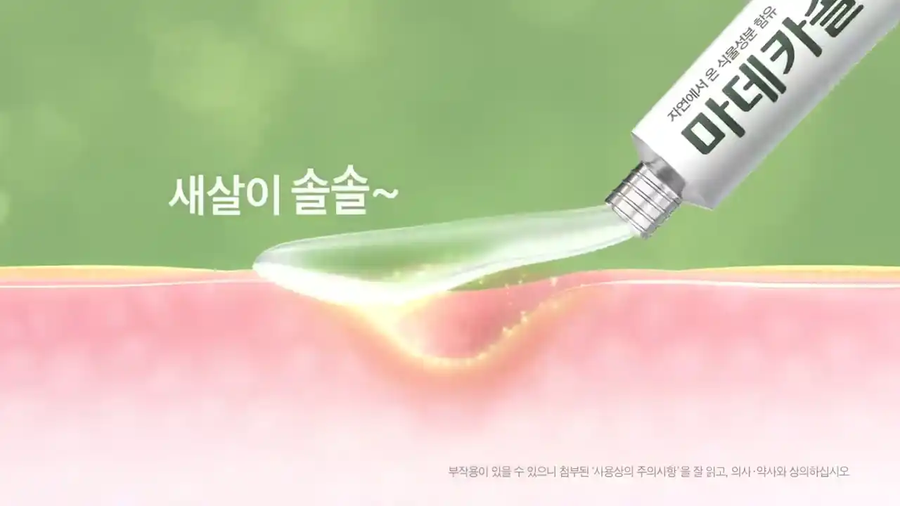 마데카솔겔 효능과 가격 피부재생