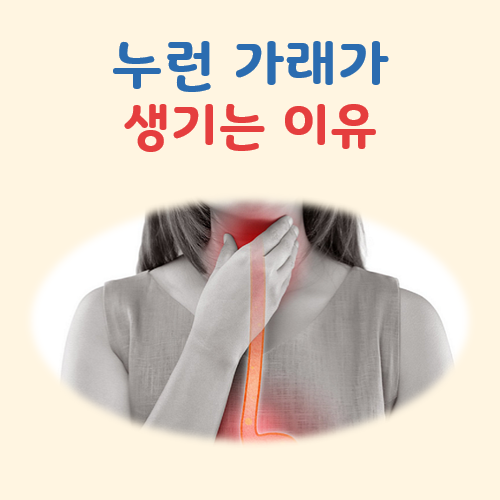 누런 가래 생기는 이유 대표 이미지